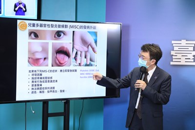 全台數例MIS-C 王志堯院長:請家長留意、盡早送醫